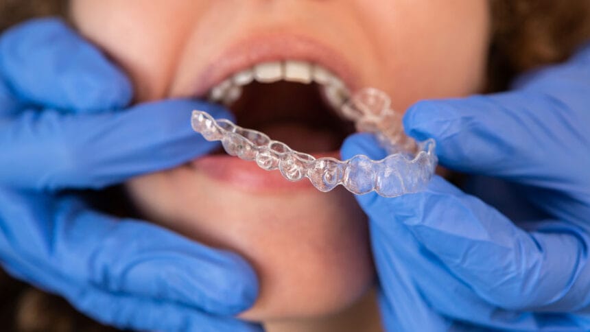 gutiera dentara